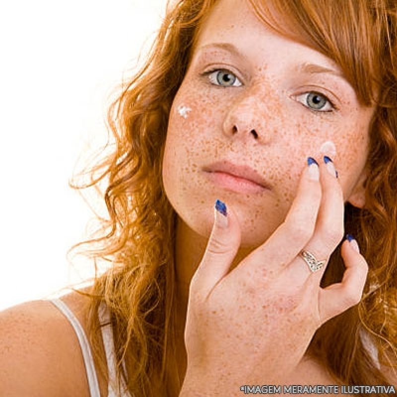 Onde Manipula Dermocosméticos para Manchas Bom Clima - Dermocosméticos Acne